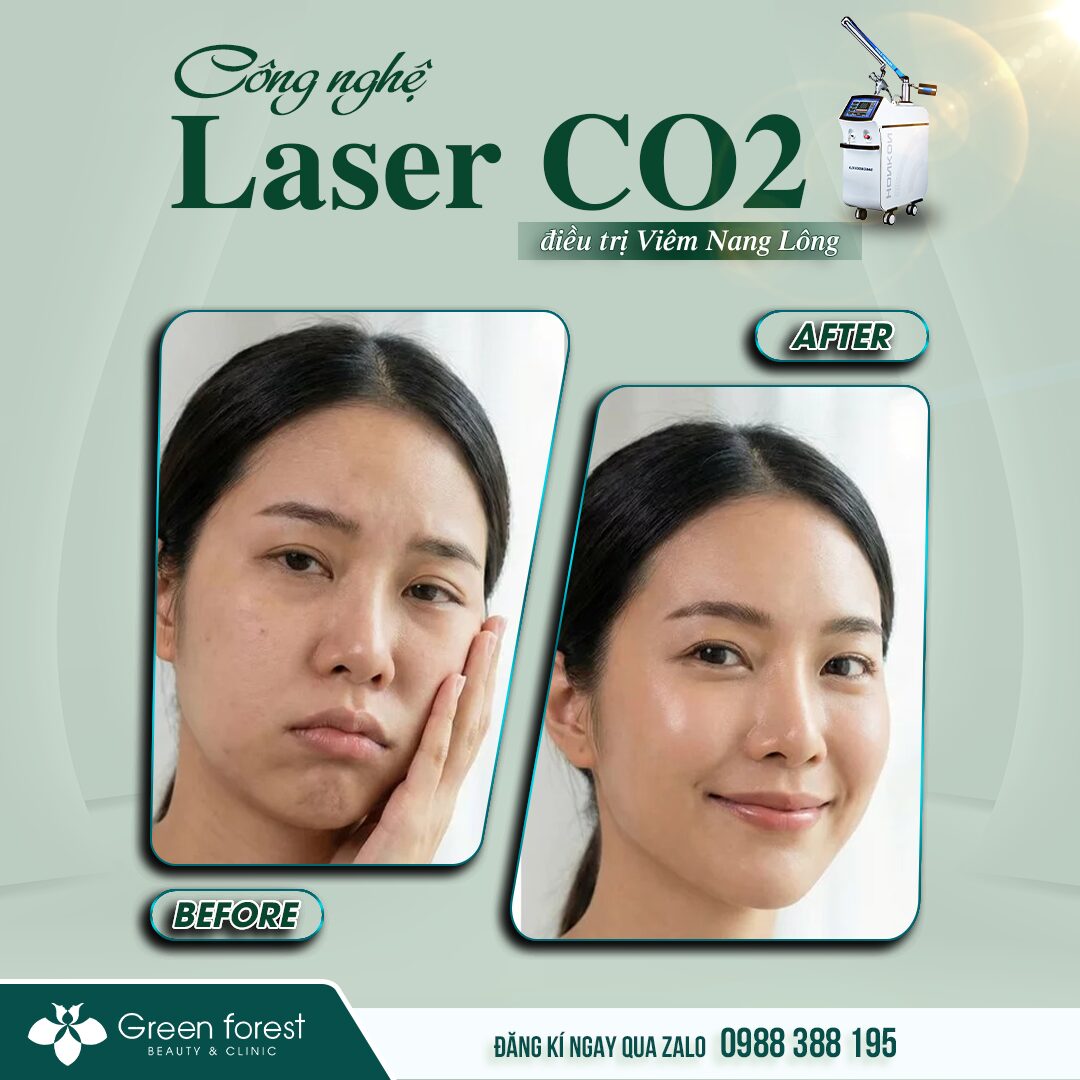 Kết quả chăm sóc da dày sừng nang lông đúng routine