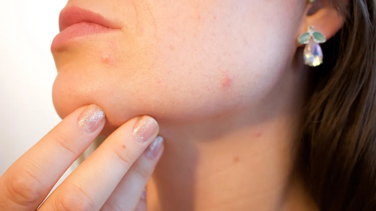 xét nghiệm phân biệt viêm nang lông vi khuẩn nấm