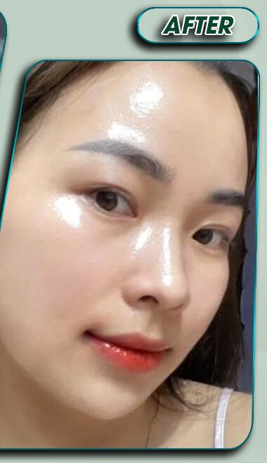 Sau điều trị
