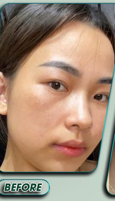 Trước điều trị